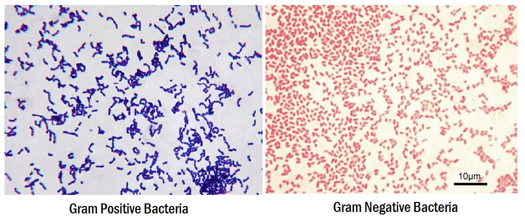 Gram-positive and Gram-negative bacteria staining
