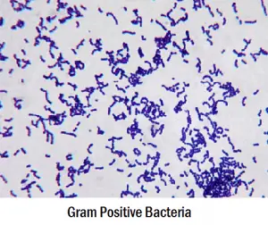 Differences Between Gram Positive and Gram Negative Bacteria