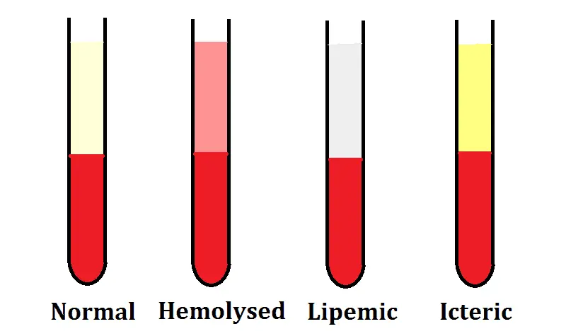 Hemolysed-Lipemic-Icteric-Samples