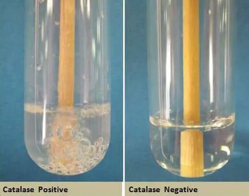 Tube method for catalase test image photo picture