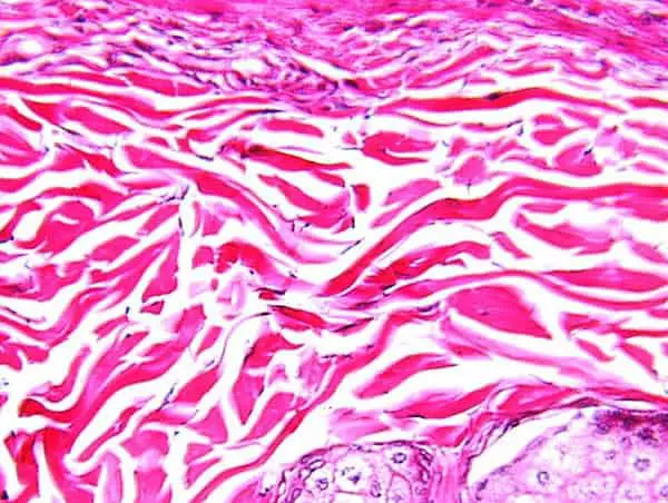 A closer look at dense irregular connective tissues