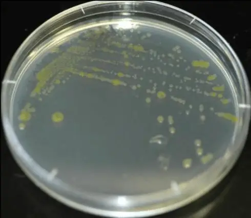 A pure bacterial isolate using the streak plate technique