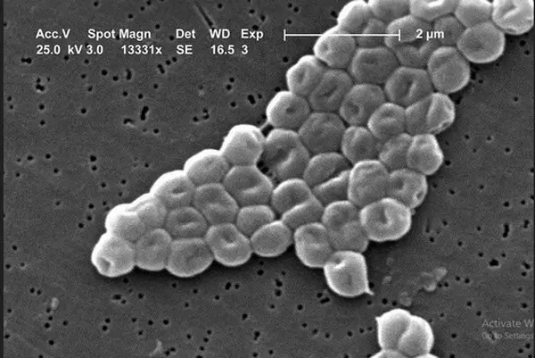Acinetobacter baumannii image