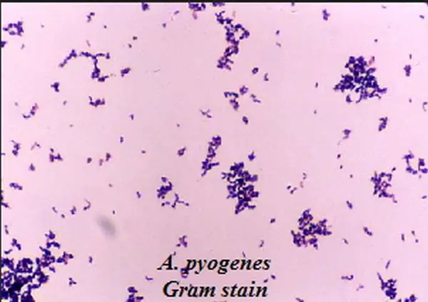Gram positive rods image picture