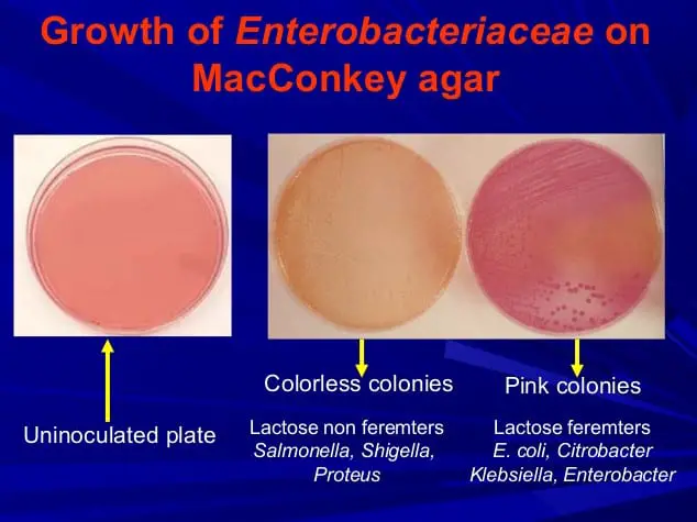 Growth of Enterobacteriaceae on a MacConkey Agar
