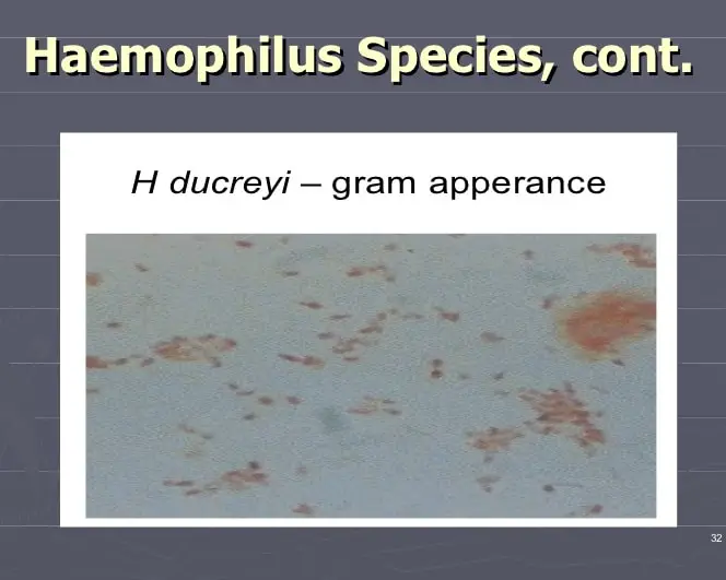 Haemophilus species image