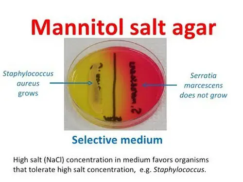 Mannitol salt agar test as a part of a selective medium