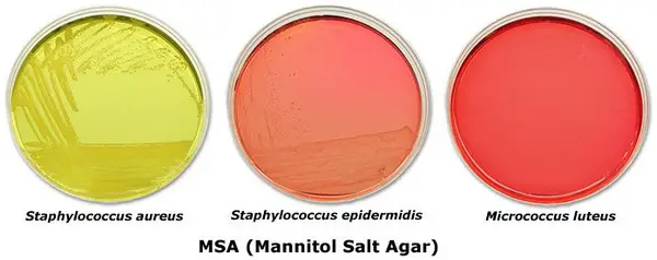 Mannitol salt agar test
