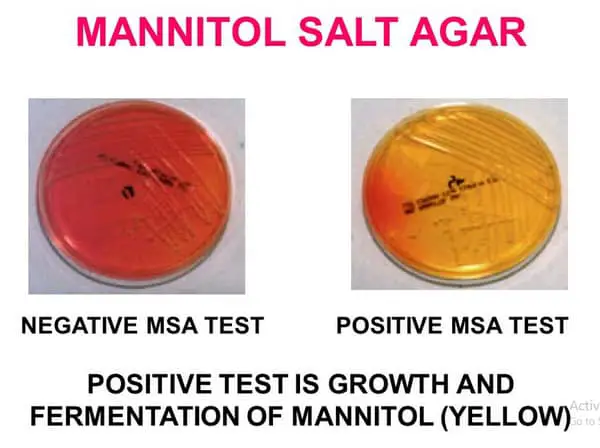 Mannitol salt agar