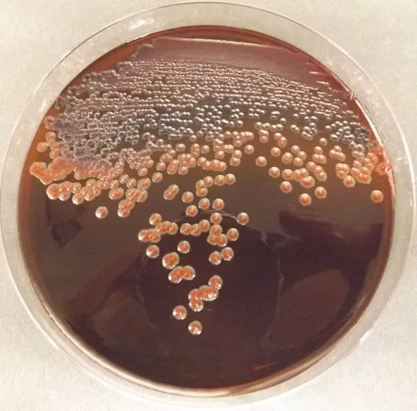 Pseudomonas microorganisms are tested on the emb agar