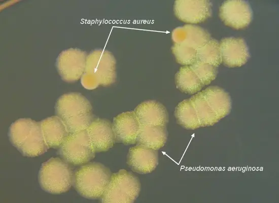 S. aureus and P. aeruginosa microorganisms on a tryptic soy agar