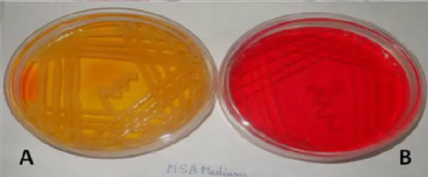 Staphylococcus epidermidis on mannitol salt agar
