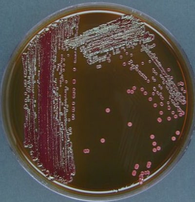 emb agar with formed colonies of microorganisms