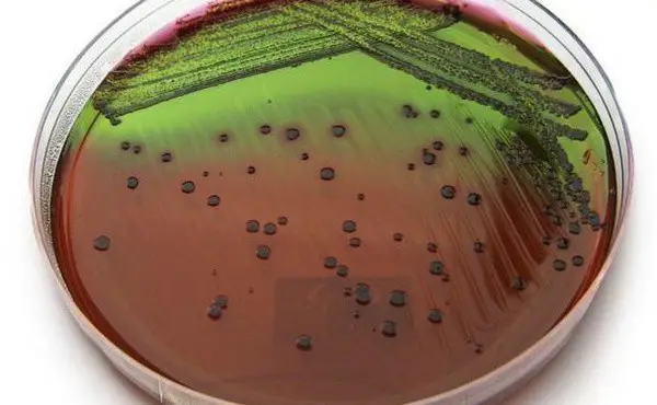 image shows colonies of E. coli in the emb agar