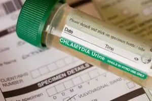 Chlamydia Test (How to test for chlamydia at home – kit)