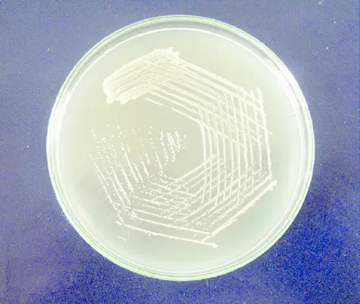 A Petri dish with a colony of Klebsiella on nutrient agar