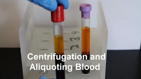 Centrifugation and aliquoting blood
