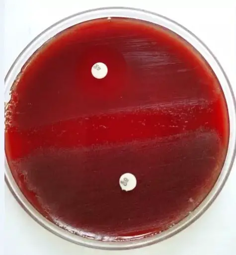 Petri plate (dish) contains a blood agar medium