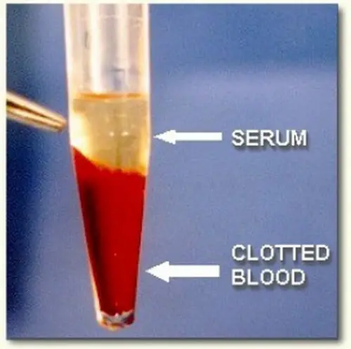 Serum is the fluid component of the blood