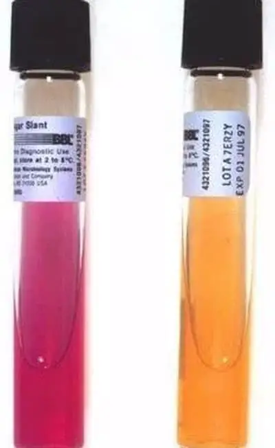 Two test tubes set for urease test; the pink test tube is urease positive while the orange test tube is negative