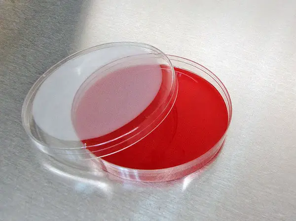 blood agar containing 5% of sheep blood