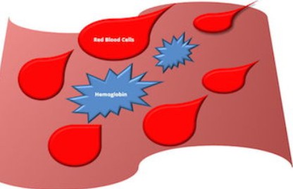 image shows the level of MCH; a proportion of hemoglobin to red blood cells