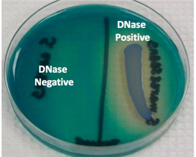 left side of the plate tests negative while the right side tests positive to DNase test