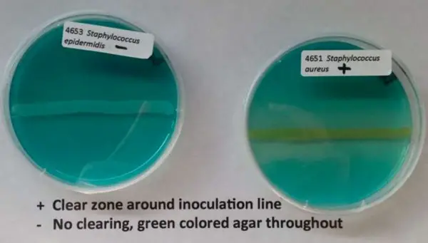 positive DNase test is characterized by a clear zone around inoculation line