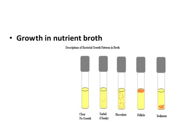 Growth of bacteria colony in nutrient broth