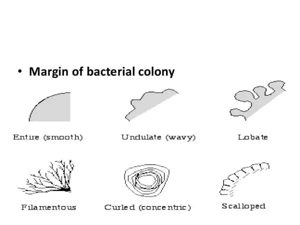 Margin of a bacterial colony