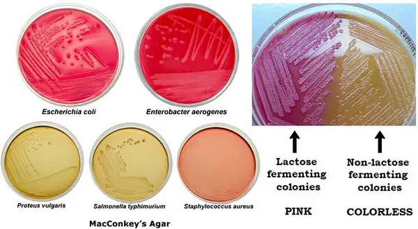 colony morphology of bacteria on MacConkey agar