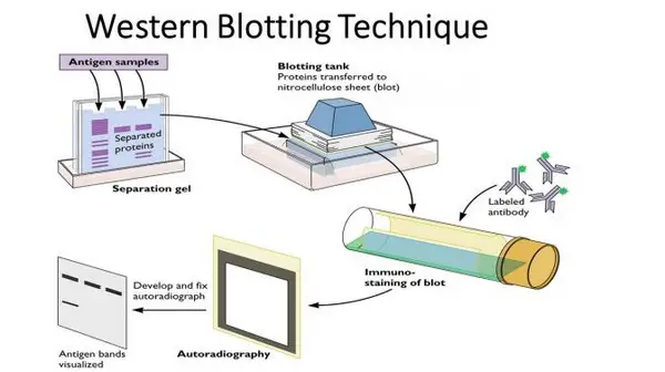 image shows the procedures involved in western blotting method