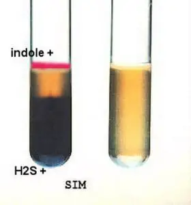 Hydrogen Sulfide Test – Procedure, Uses and Interpretation