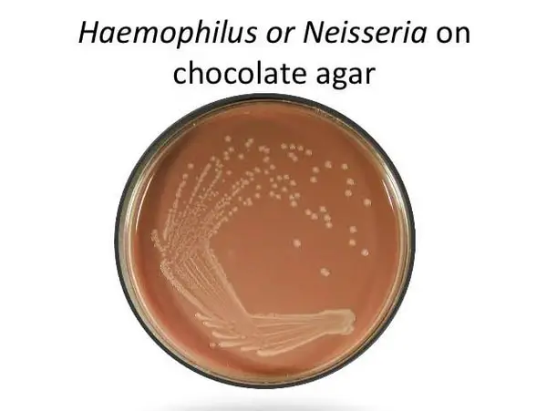 Obvious colonies of bacteria on chocolate agar