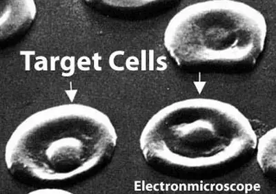closer look at the target cells using an electron microscope