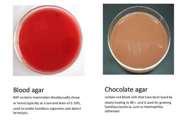 comparison image between chocolate and blood agar