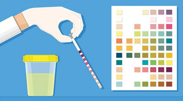 urine test strip can be used to check for the level of ketones in urine at home