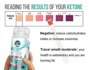 Ketones in Urine (Ketonuria) – Clinical importance, How to perform test (Normal values) and interpretation