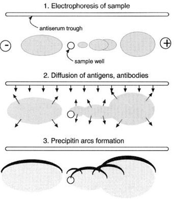 Interpreting the result of a sample subjected to immunoelectrophoresis