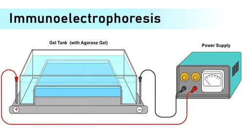 immunoelectrophoresis procedure is performed using the machine as illustrated in the image
