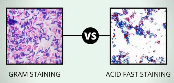 Gram staining and Acid-fast staining