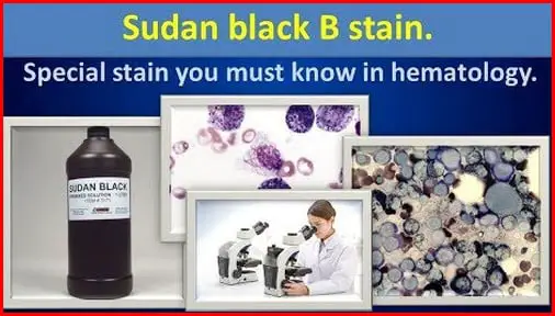 The image above shows the actual Sudan Black B Stain used in special hematological process pictures
