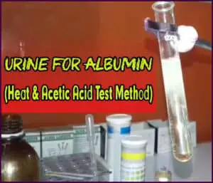 Heat and Acetic Acid Test (Urine test of proteinuria)