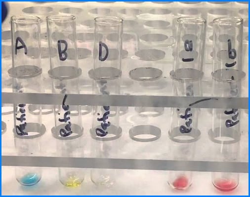 The image above shows the reverse blood grouping method using the test tubes images and pictures