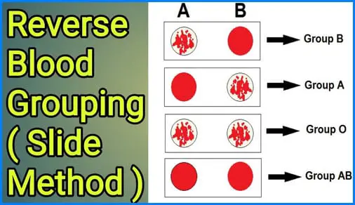 The image above shows the reverse blood grouping procedure using the slide method pciture and image