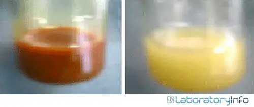 Figure: mayer's test Formation of cream or whitish precipitates right indicating a positive result. The left picture shows a negative outcome.